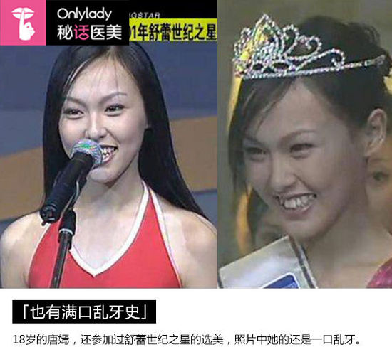 十亿女王唐嫣变脸过程 旧照乱牙挑高眉(图)