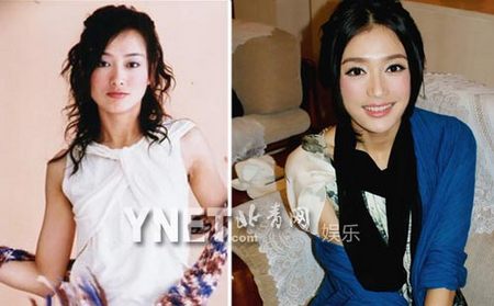 秦岚整容前后对比照 网友:明星整容失败的又一