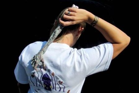 身体发痒要警惕 皮肤瘙痒暗示10大病