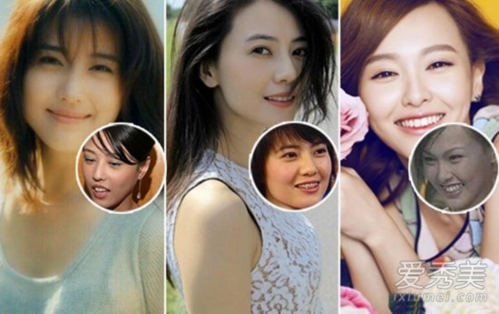 唐嫣曾是龅牙妹 女星靠整牙变天仙
