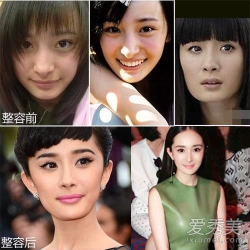 baby范冰冰杨幂否认整容 这些"证据"你信?