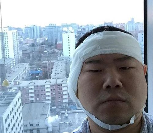 岳云鹏术后头缠绷带切黄瓜 网友大呼好心酸【2】