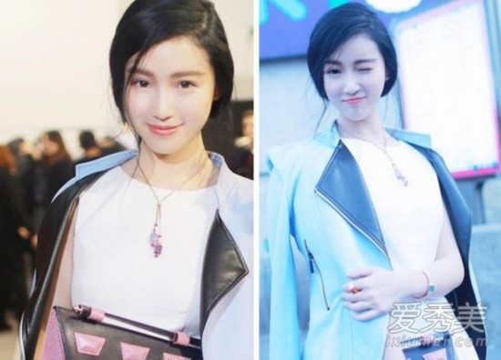 张辛苑再次变脸  面部浮肿 紧绷难 辨认 --人民网