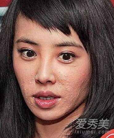 杨幂鱼尾纹范冰冰黑眼圈汤唯皮肤黑唐嫣长痘
