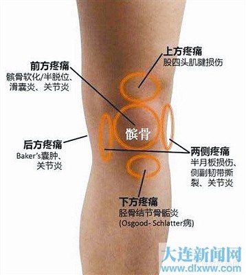 一张图告诉你不同位置膝关节疼痛怎么治疗