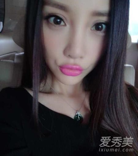 人鱼小姐张瑞希面瘫美貌不再 图揭整容失败女