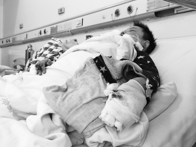 河南12岁少年边玩手机边充电 手机爆炸脸被炸