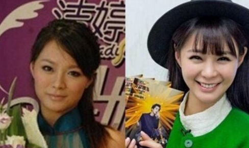 沈夢辰整容前后對比照