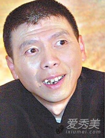 Baby全智贤赵雅芝 一口烂牙毁掉颜值--人民网