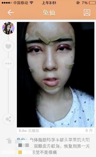 <em>15岁</em>萌<em>妹子</em>整容变蛇精 高调炫富私照全公开--河