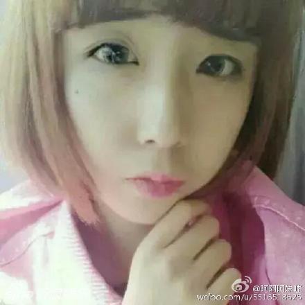 <em>15</em>岁<em>女孩</em>整成蛇精脸 自曝整容过程--重庆视窗