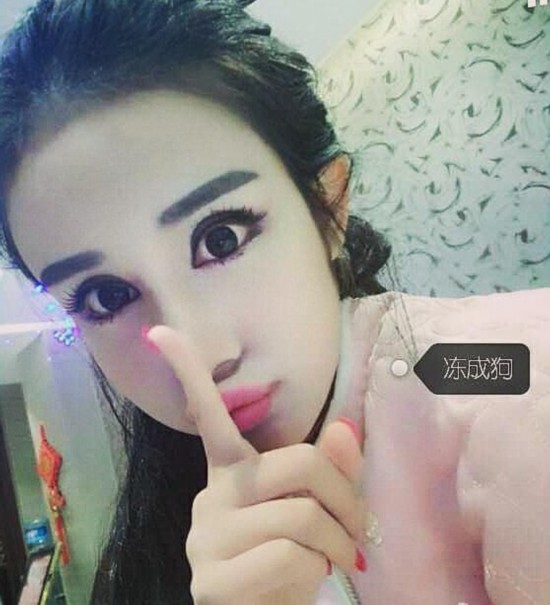 15岁女孩整成蛇精脸 自曝整容过程-人民网