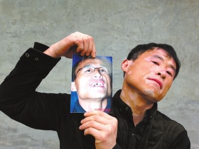 出狱后,贾相军第一时间拍了张照片,记录其门牙缺失的状态。京华时报记者李显峰摄