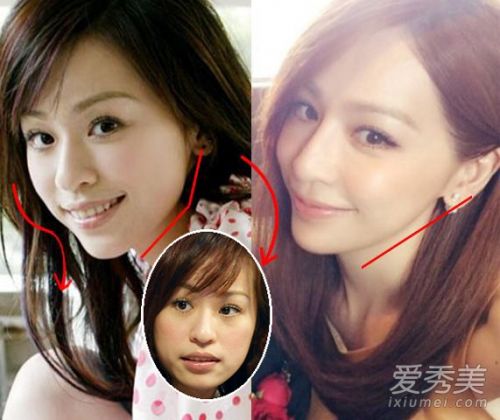 杨幂baby王心凌林依晨 娱乐圈整容女星大曝光