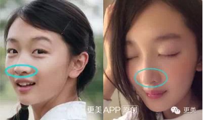 周冬雨公开男友情史曝光 周冬雨割双眼皮旧照