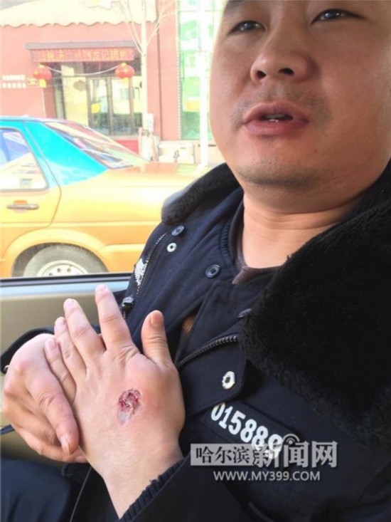 女子疗情伤喝醉酒 砸店砸车咬掉民警肉(图)