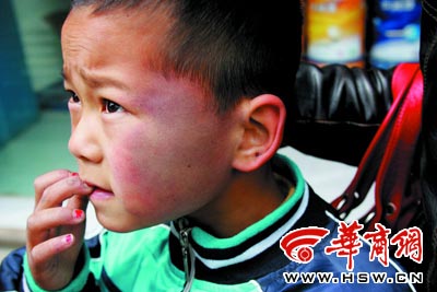 男童走失饿死救助站 盘点残忍 虐童事件 --山东频