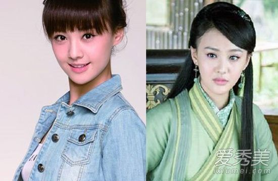 嘴角下垂显老气 郑爽领衔微笑唇整容小心机(