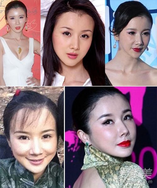 娱乐圈9大"整容女"假脸看醉了!(图)