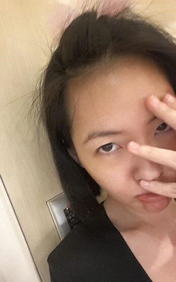 小S发文称后悔与<em>女儿发脾气</em> 下巴红肿引粉丝注