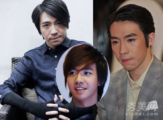 胡歌 俞灏明 疤痕明显 明星 毁容 前后唏嘘对比--河