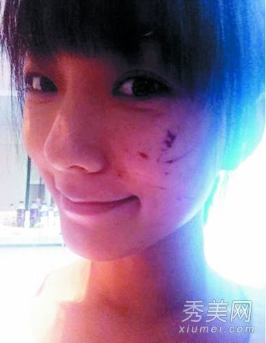 胡歌 俞灏明 疤痕明显 明星 毁容 前后唏嘘对比--河