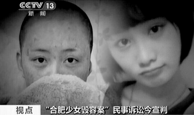 合肥 少女毁容 案周岩 获赔 170多万 周家不满意