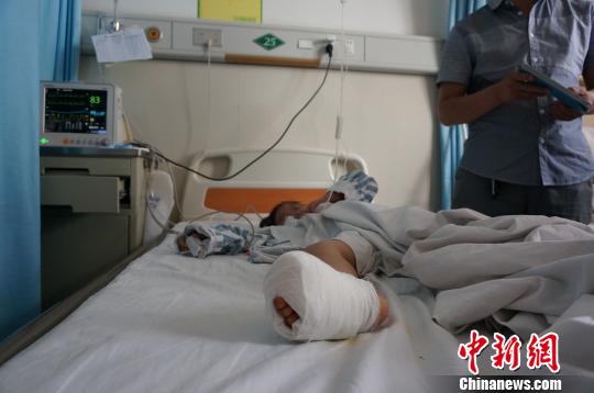 湖北一7岁女孩用橡皮筋紧勒脚指3天遭截肢