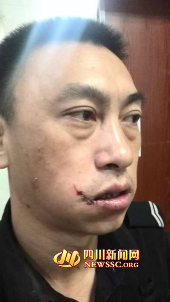 男子穿白大褂潜入医院淡定行窃 保安阻止被戳