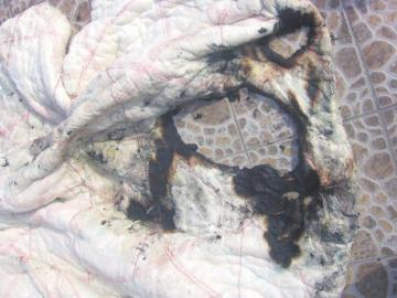 楼上乱丢烟头 楼下棉被著火 检测DNA找到肇事