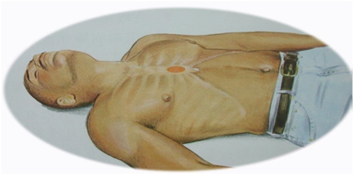 心肺复苏 黄金4分钟 半数患者可能被救活