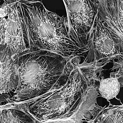 显微镜下的人体, 那画面太美你不敢看