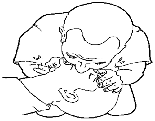 心肺复苏 黄金4分钟 半数患者可能被救活