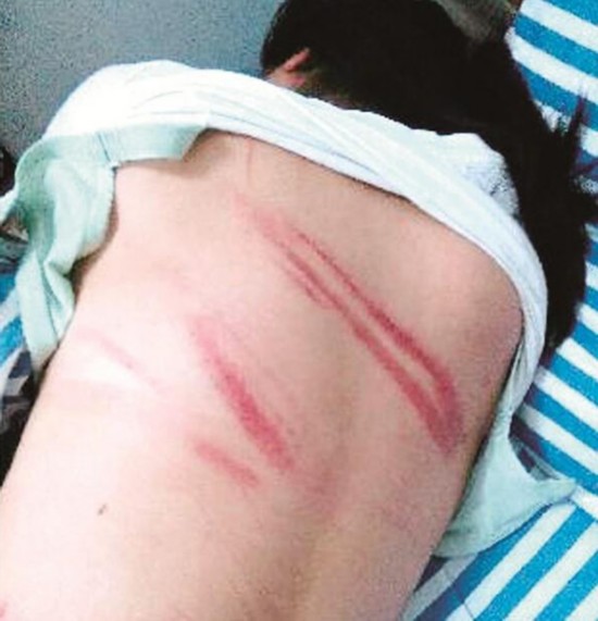 鲁女士说,她的公爹当时先扯下了蒙车牌的布,后来又扯下了车牌,因此被