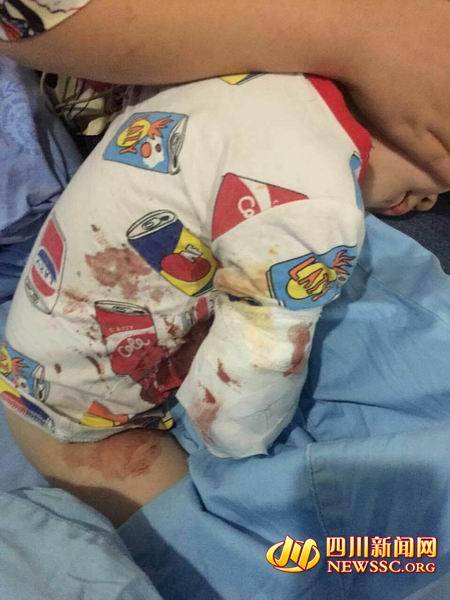 男童动物园被白虎咬掉右臂 肘关节以下全没(图