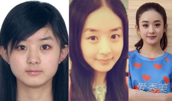 赵丽颖包子脸受宠 8位"锥子脸"女星后悔了!