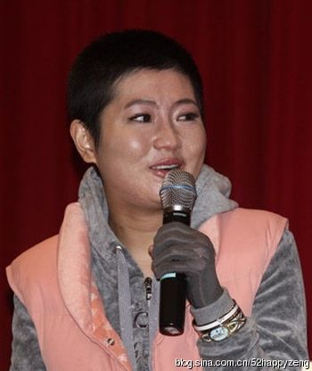 意外惨 毁容 的明星: 俞灏明 烧伤胡歌车祸  毁容 前