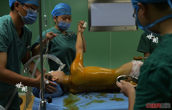 图片故事:模特隆胸记(高清组图)