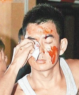 鸟叔杭州出车祸劳斯莱斯撞公交 明星出意外悲