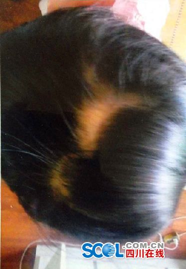 <em>3岁</em>女童<em>幼儿</em>园内7天2次受伤 <em>头发</em>被扯掉(图)--