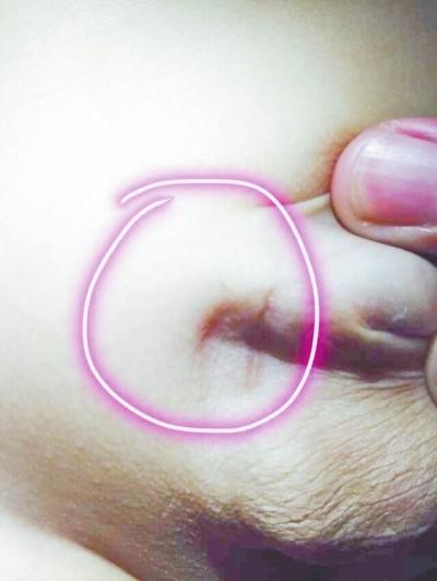 老师针扎幼儿小鸡鸡 警方已介入调查(图)