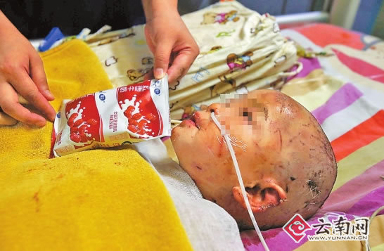 惨遭恶狗撕咬女童出院了 尽管走路还不稳似乎