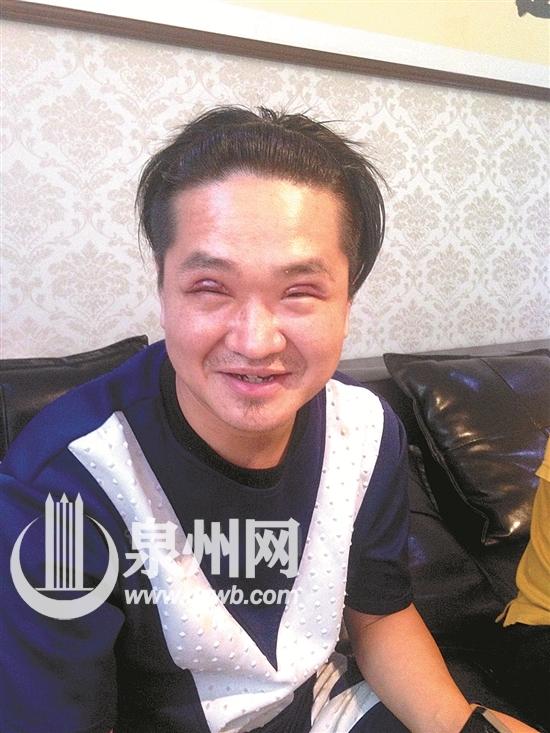 泉州男生为找工作暑期纷纷去整形 多做隆鼻手