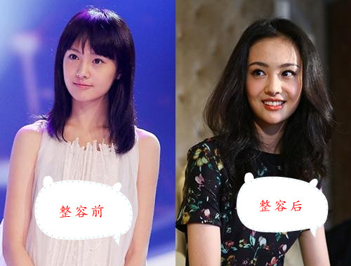郑爽胡彦斌恋情坐实 郑爽曾为张翰整容