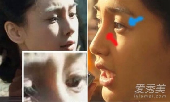 angelababy:鼻梁