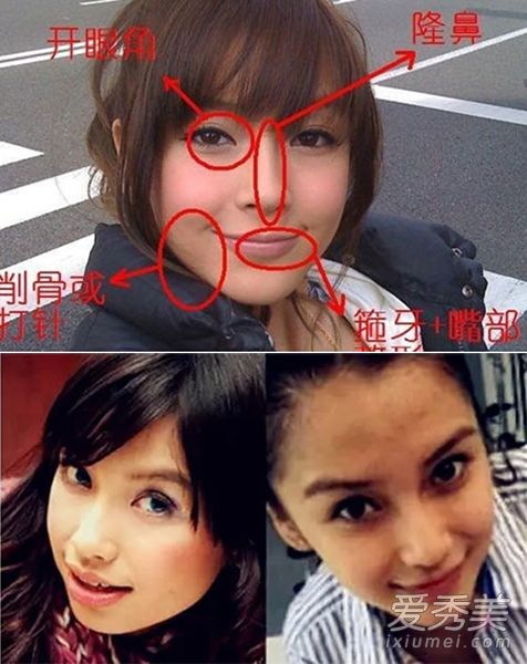 baby下巴 小s鼻子 假体暴露也不承认整容(图)