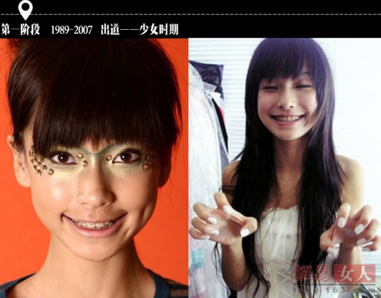 别小看 牙套妹 深扒Angelababy的女神之路(组图