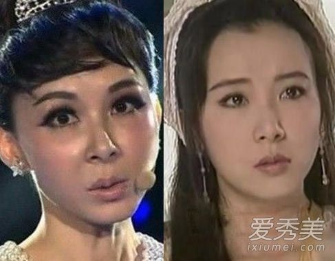 明星整容屡见不鲜,可是过了保鲜期,面对整容