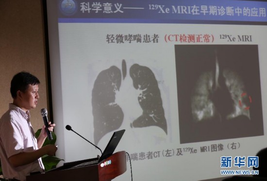 中科院研究团队点亮人体肺部