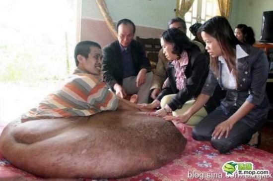 十大怪病:河南大学生患怪病 当人肉沙包赚钱